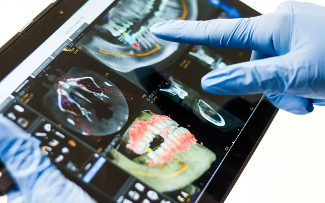 Glossary of Dental Terms