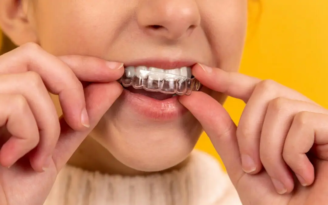 Invisalign